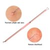 Set 4 piese din otel inoxidabil pentru curatarea tenului Rose Set 4 piese din otel inoxidabil pentru curatarea tenului Rose