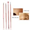 Set 4 piese din otel inoxidabil pentru curatarea tenului Rose1 Set 4 piese din otel inoxidabil pentru curatarea tenului Rose