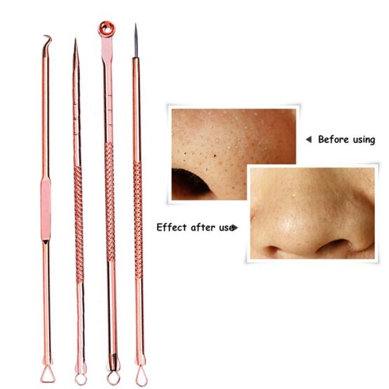 Set 4 piese din otel inoxidabil pentru curatarea tenului Rose1 Set 4 piese din otel inoxidabil pentru curatarea tenului Rose