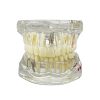 Model dentar anatomia maxilarului si dintilor Model dentar anatomia maxilarului si dintilor