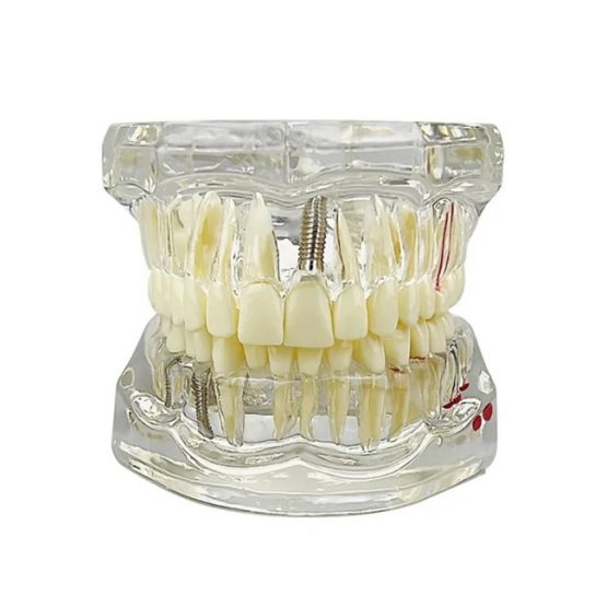 Model dentar anatomia maxilarului si dintilor Model dentar anatomia maxilarului si dintilor
