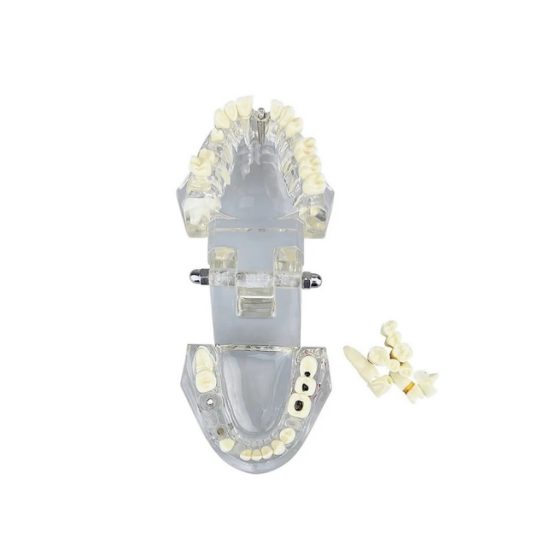 Model dentar anatomia maxilarului si dintilor Model dentar anatomia maxilarului si dintilor