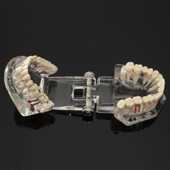 Model dentar anatomia maxilarului si dintilorModel dentar anatomia maxilarului si dintilor Model dentar anatomia maxilarului si dintilor