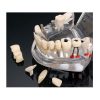 Model dentar anatomia maxilarului si dintilor Model dentar anatomia maxilarului si dintilor