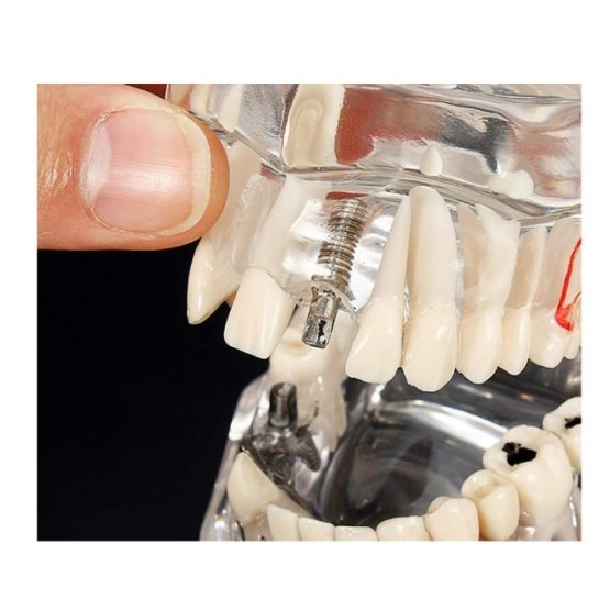 Model dentar anatomia maxilarului si dintilor Model dentar anatomia maxilarului si dintilor