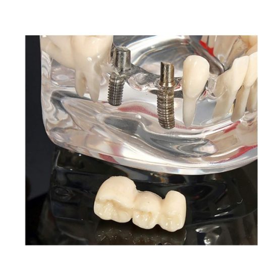 Model dentar anatomia maxilarului si dintilor Model dentar anatomia maxilarului si dintilor