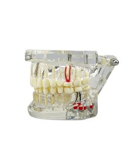 Model dentar anatomia maxilarului si dintilor