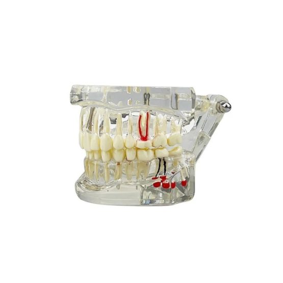 Model dentar anatomia maxilarului si dintilor Model dentar anatomia maxilarului si dintilor