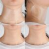 Plasture antirid si antiaging reutilizabil