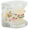 Model aparat dentar cu bracketi pentru anatomia maxilarului si dintilor, Transparent - KESNUP