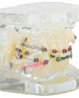 Model aparat dentar cu bracketi pentru anatomia maxilarului si dintilor, Transparent - KESNUP