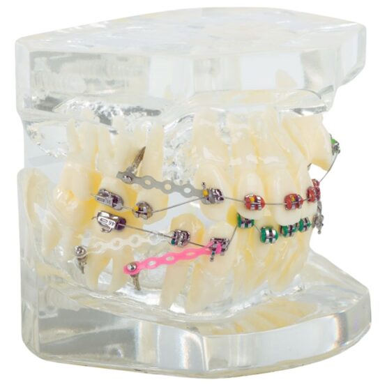 Model aparat dentar cu bracketi pentru anatomia maxilarului si dintilor, Transparent - KESNUP