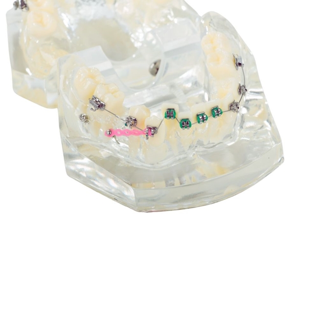 Model aparat dentar cu bracketi pentru anatomia maxilarului si dintilor, Transparent - KESNUP