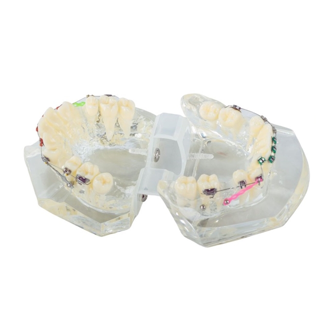 Model aparat dentar cu bracketi pentru anatomia maxilarului si dintilor, Transparent - KESNUP