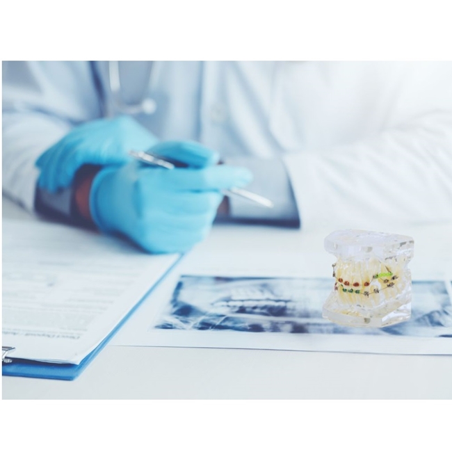 Model aparat dentar cu bracketi pentru anatomia maxilarului si dintilor, Transparent - KESNUP