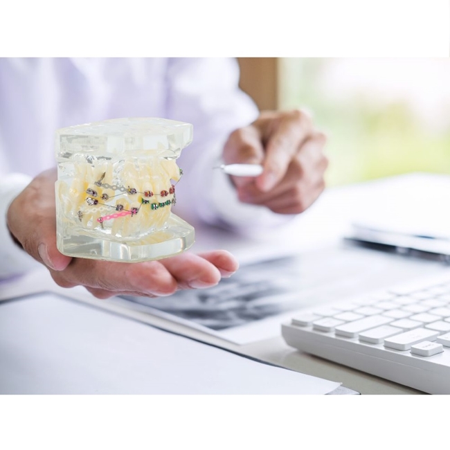 Model aparat dentar cu bracketi pentru anatomia maxilarului si dintilor, Transparent - KESNUP