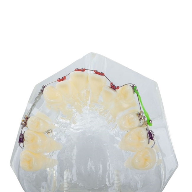 Model aparat dentar cu bracketi pentru anatomia maxilarului si dintilor, Transparent - KESNUP