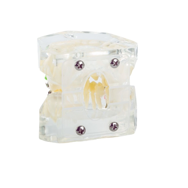 Model aparat dentar cu bracketi pentru anatomia maxilarului si dintilor, Transparent - KESNUP