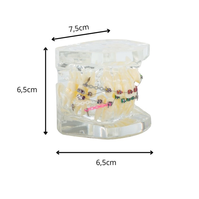Model aparat dentar cu bracketi pentru anatomia maxilarului si dintilor, Transparent - KESNUP