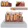 Model mulaj anatomic dinte KESNUP, model dentar oral realistic, pentru cabinet stomatologic, demonstratii stomatologice, facultate stomatologie, dimensiune baza 16.1 x 12.5 cm, mulaj 13.8 x 8.5 x cm, material rasina, Multicolor 1 Model mulaj anatomic dinte KESNUP, model dentar oral realistic, pentru cabinet stomatologic, demonstratii stomatologice, facultate stomatologie, dimensiune baza 16.1 x 12.5 cm, mulaj 13.8 x 8.5 x cm, material rasina, Multicolor