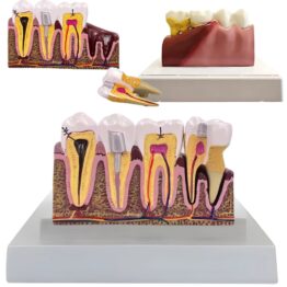 Model mulaj anatomic dinte KESNUP, model dentar oral realistic, pentru cabinet stomatologic, demonstratii stomatologice, facultate stomatologie, dimensiune baza 16.1 x 12.5 cm, mulaj 13.8 x 8.5 x cm, material rasina, Multicolor