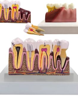 Model mulaj anatomic dinte KESNUP, model dentar oral realistic, pentru cabinet stomatologic, demonstratii stomatologice, facultate stomatologie, dimensiune baza 16.1 x 12.5 cm, mulaj 13.8 x 8.5 x cm, material rasina, Multicolor
