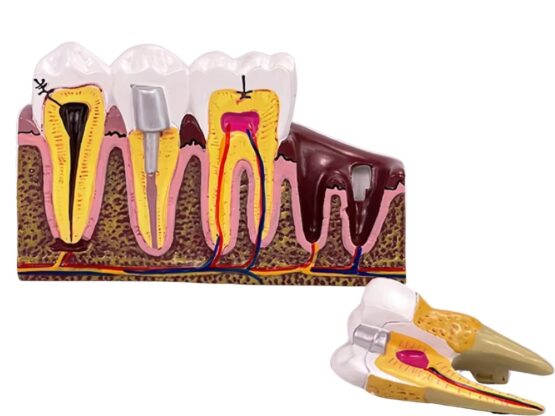 Model mulaj anatomic dinte KESNUP, model dentar oral realistic, pentru cabinet stomatologic, demonstratii stomatologice, facultate stomatologie, dimensiune baza 16.1 x 12.5 cm, mulaj 13.8 x 8.5 x cm, material rasina, Multicolor 2 Model mulaj anatomic dinte KESNUP, model dentar oral realistic, pentru cabinet stomatologic, demonstratii stomatologice, facultate stomatologie, dimensiune baza 16.1 x 12.5 cm, mulaj 13.8 x 8.5 x cm, material rasina, Multicolor