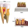 Model mulaj anatomic dinte KESNUP, model dentar oral realistic, pentru cabinet stomatologic, demonstratii stomatologice, facultate stomatologie, dimensiune baza 16.1 x 12.5 cm, mulaj 13.8 x 8.5 x cm, material rasina, Multicolor 3 Model mulaj anatomic dinte KESNUP, model dentar oral realistic, pentru cabinet stomatologic, demonstratii stomatologice, facultate stomatologie, dimensiune baza 16.1 x 12.5 cm, mulaj 13.8 x 8.5 x cm, material rasina, Multicolor