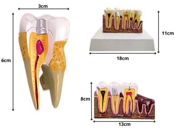 Model mulaj anatomic dinte KESNUP, model dentar oral realistic, pentru cabinet stomatologic, demonstratii stomatologice, facultate stomatologie, dimensiune baza 16.1 x 12.5 cm, mulaj 13.8 x 8.5 x cm, material rasina, Multicolor 3 Model mulaj anatomic dinte KESNUP, model dentar oral realistic, pentru cabinet stomatologic, demonstratii stomatologice, facultate stomatologie, dimensiune baza 16.1 x 12.5 cm, mulaj 13.8 x 8.5 x cm, material rasina, Multicolor