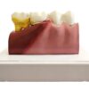 Model mulaj anatomic dinte KESNUP, model dentar oral realistic, pentru cabinet stomatologic, demonstratii stomatologice, facultate stomatologie, dimensiune baza 16.1 x 12.5 cm, mulaj 13.8 x 8.5 x cm, material rasina, Multicolor 5 Model mulaj anatomic dinte KESNUP, model dentar oral realistic, pentru cabinet stomatologic, demonstratii stomatologice, facultate stomatologie, dimensiune baza 16.1 x 12.5 cm, mulaj 13.8 x 8.5 x cm, material rasina, Multicolor