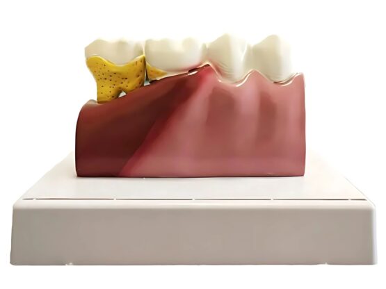 Model mulaj anatomic dinte KESNUP, model dentar oral realistic, pentru cabinet stomatologic, demonstratii stomatologice, facultate stomatologie, dimensiune baza 16.1 x 12.5 cm, mulaj 13.8 x 8.5 x cm, material rasina, Multicolor 5 Model mulaj anatomic dinte KESNUP, model dentar oral realistic, pentru cabinet stomatologic, demonstratii stomatologice, facultate stomatologie, dimensiune baza 16.1 x 12.5 cm, mulaj 13.8 x 8.5 x cm, material rasina, Multicolor