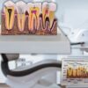 Model mulaj anatomic dinte KESNUP, model dentar oral realistic, pentru cabinet stomatologic, demonstratii stomatologice, facultate stomatologie, dimensiune baza 16.1 x 12.5 cm, mulaj 13.8 x 8.5 x cm, material rasina, Multicolor 6 Model mulaj anatomic dinte KESNUP, model dentar oral realistic, pentru cabinet stomatologic, demonstratii stomatologice, facultate stomatologie, dimensiune baza 16.1 x 12.5 cm, mulaj 13.8 x 8.5 x cm, material rasina, Multicolor