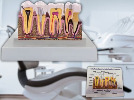 Model mulaj anatomic dinte KESNUP, model dentar oral realistic, pentru cabinet stomatologic, demonstratii stomatologice, facultate stomatologie, dimensiune baza 16.1 x 12.5 cm, mulaj 13.8 x 8.5 x cm, material rasina, Multicolor 6 Model mulaj anatomic dinte KESNUP, model dentar oral realistic, pentru cabinet stomatologic, demonstratii stomatologice, facultate stomatologie, dimensiune baza 16.1 x 12.5 cm, mulaj 13.8 x 8.5 x cm, material rasina, Multicolor