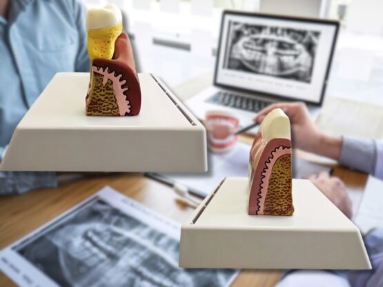 Model mulaj anatomic dinte KESNUP, model dentar oral realistic, pentru cabinet stomatologic, demonstratii stomatologice, facultate stomatologie, dimensiune baza 16.1 x 12.5 cm, mulaj 13.8 x 8.5 x cm, material rasina, Multicolor 7 Model mulaj anatomic dinte KESNUP, model dentar oral realistic, pentru cabinet stomatologic, demonstratii stomatologice, facultate stomatologie, dimensiune baza 16.1 x 12.5 cm, mulaj 13.8 x 8.5 x cm, material rasina, Multicolor