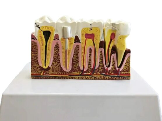 Model mulaj anatomic dinte KESNUP, model dentar oral realistic, pentru cabinet stomatologic, demonstratii stomatologice, facultate stomatologie, dimensiune baza 16.1 x 12.5 cm, mulaj 13.8 x 8.5 x cm, material rasina, Multicolor 8 Model mulaj anatomic dinte KESNUP, model dentar oral realistic, pentru cabinet stomatologic, demonstratii stomatologice, facultate stomatologie, dimensiune baza 16.1 x 12.5 cm, mulaj 13.8 x 8.5 x cm, material rasina, Multicolor